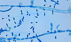 Trichophyton tonsurans